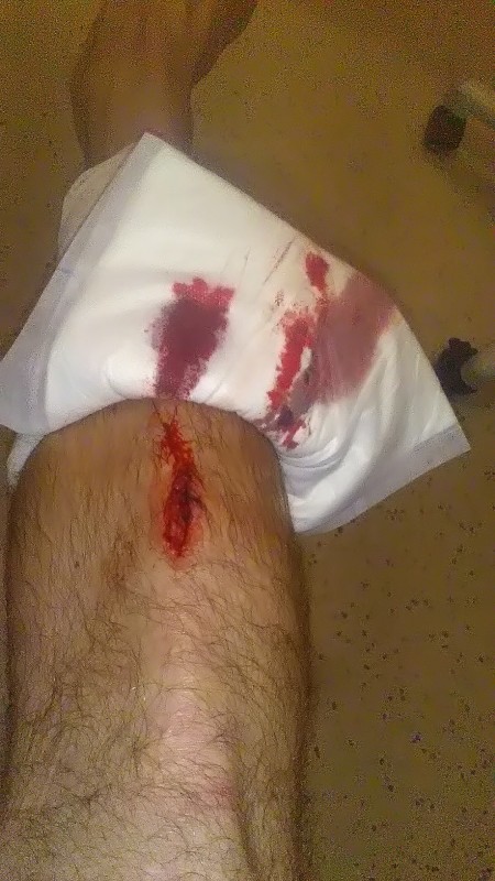 leg gash1.jpg