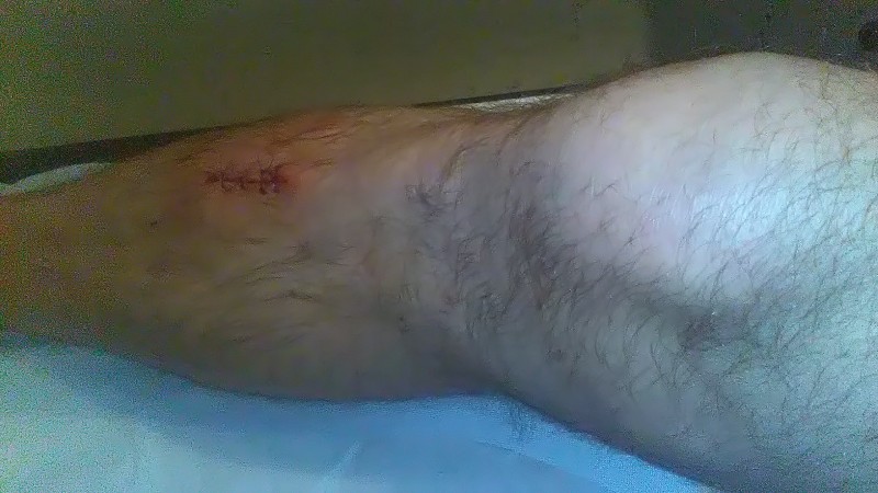 leg gash3.jpg